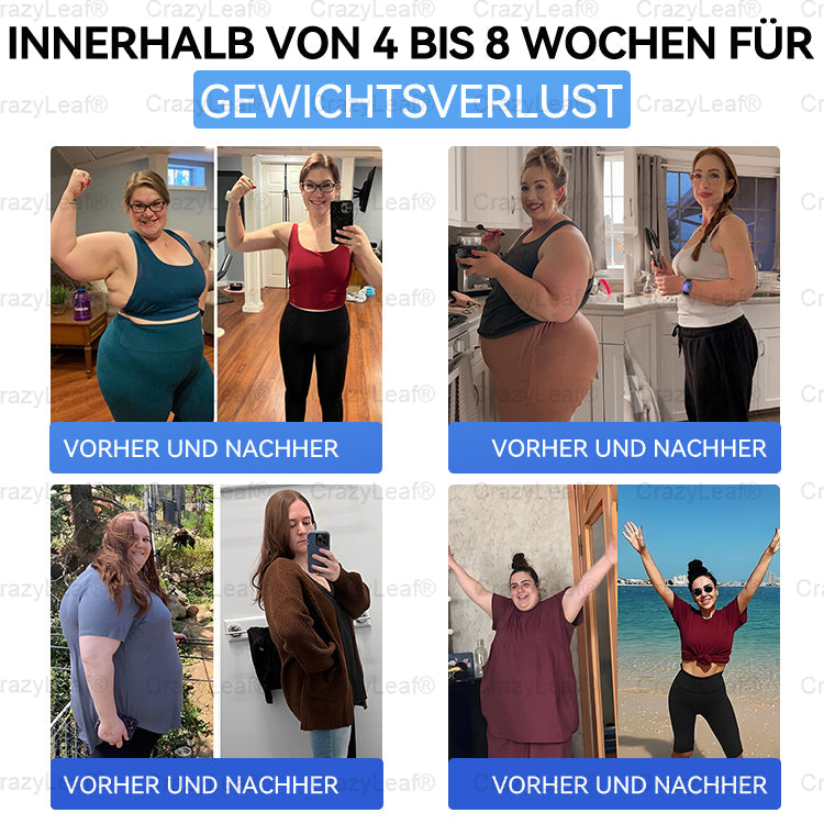 "Letzte 30 Min: 1 kaufen, 1 gratis!" CrazyLeaf® Nano-Microneedle-Pflaster mit SMGT-GLP-1, Matrixyl 3000, Botox & Kollagenpeptiden – Wirkt gegen Übergewicht, schlaffe Haut, Herzprobleme, Diabetes, Schlafapnoe, Gelenkbeschwerden u.v.m. 1