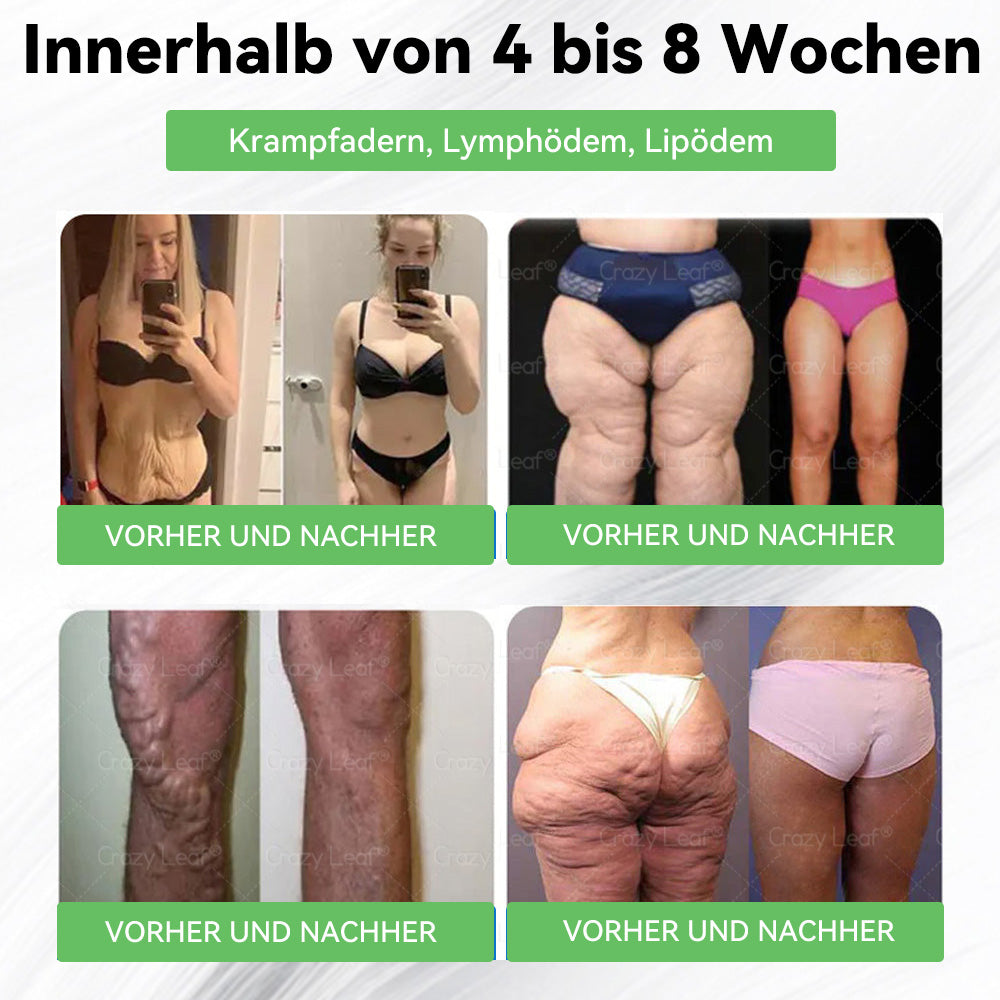 CrazyLeaf® Nur noch 5 Flaschen verfügbar! Wir bieten Ihnen zusätzlich einen 30% Rabatt! Machen Sie sich fit und gesund. Verpassen Sie es jetzt, und Sie haben erst nächstes Jahr wieder eine Chance.