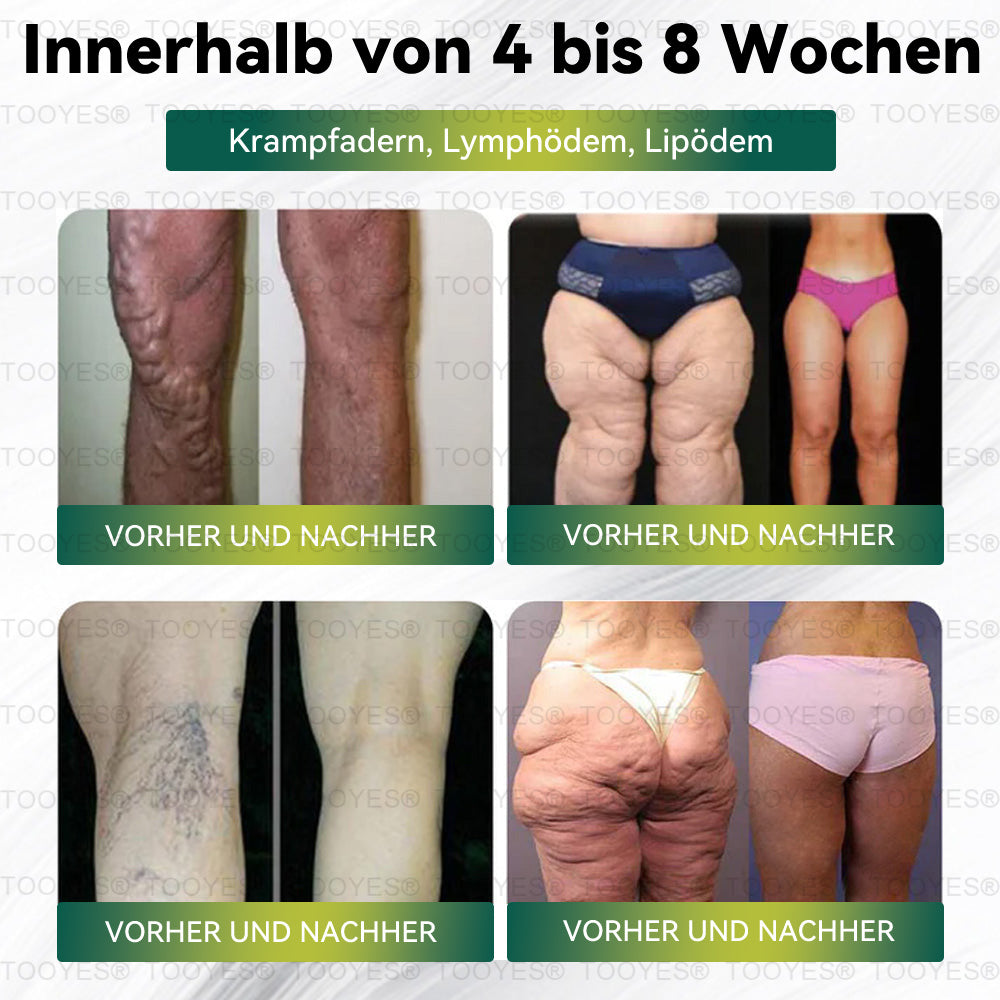 TOOYES® Letzte Chance! Sichern Sie sich dieses Glücksangebot mit 60% Rabatt!