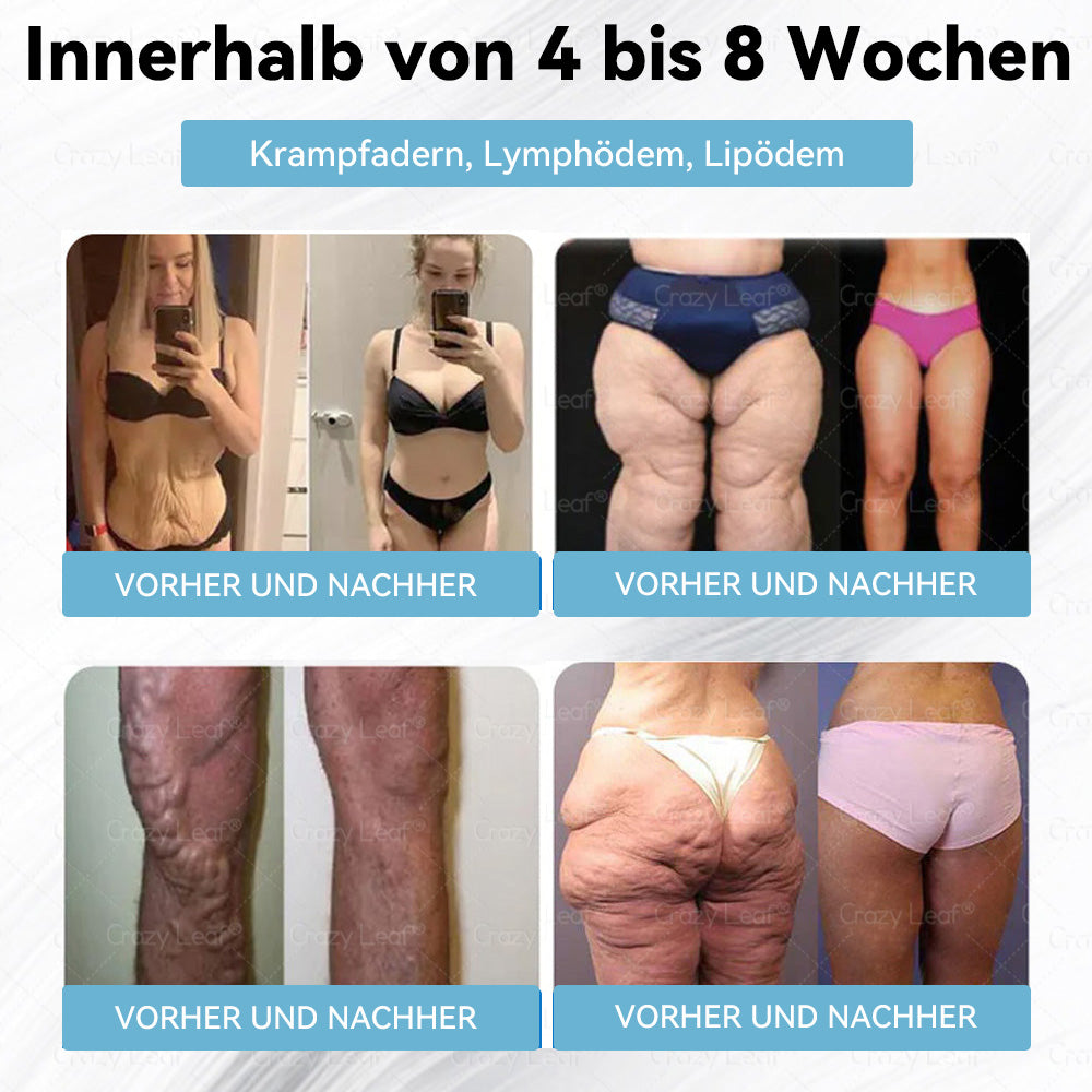 CrazyLeaf® Letzte Chance! Sichern Sie sich dieses Glücksangebot mit 60% Rabatt!