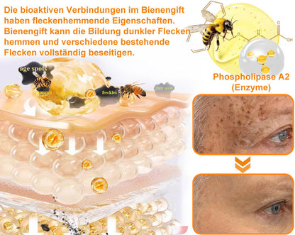 (Letzter Tag 80% Rabatt) YSMYSM® leistungsstarke Ganzkörper-Hautpflegecreme