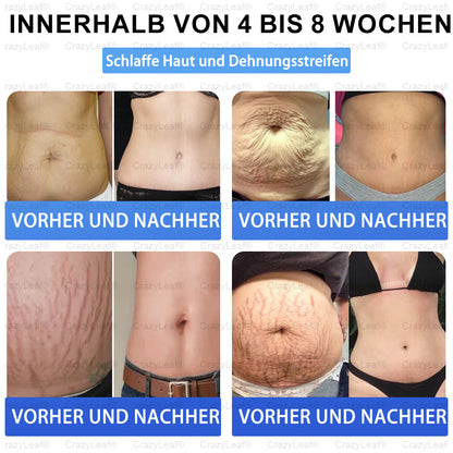 CrazyLeaf® Nur noch 5 Flaschen verfügbar! Wir bieten Ihnen zusätzlich einen 40% Rabatt! Machen Sie sich fit und gesund. Verpassen Sie es jetzt, und Sie haben erst nächstes Jahr wieder eine Chance.