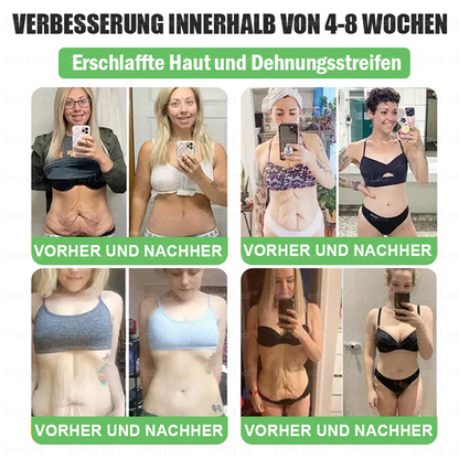 [ 𝑳𝒆𝒕𝒛𝒕𝒆 30 𝑴𝒊𝒏𝒖𝒕𝒆𝒏: 𝑲𝒂𝒖𝒇𝒆 5, 𝒆𝒓𝒉𝒂𝒍𝒕𝒆 5 𝒈𝒓𝒂𝒕𝒊𝒔! 🇩🇪] 𝐂𝒓𝓪𝙯𝙮𝐋𝑒𝑎𝐟® 𝚂𝖬𝐺𝘛-𝘎𝐿𝙋-1 Orallösung gegen Übergewicht, Bluthochdruck, Blutzucker- & Fettleberprobleme, Gelenkschmerzen, Müdigkeit, Energiemangel & schlaffe Haut – für mehr Gesundheit & Vitalität. 03