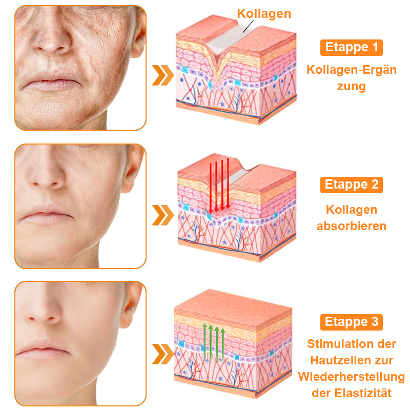 (Letzter Tag 80% Rabatt) YSMYSM® leistungsstarke Ganzkörper-Hautpflegecreme