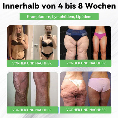 [ 𝑳𝒆𝒕𝒛𝒕𝒆 30 𝑴𝒊𝒏𝒖𝒕𝒆𝒏: 𝑲𝒂𝒖𝒇𝒆 5, 𝒆𝒓𝒉𝒂𝒍𝒕𝒆 5 𝒈𝒓𝒂𝒕𝒊𝒔! 🇩🇪] 𝐂𝒓𝓪𝙯𝙮𝐋𝑒𝑎𝐟® 𝚂𝖬𝐺𝘛-𝘎𝐿𝙋-1 Orallösung gegen Übergewicht, Bluthochdruck, Blutzucker- & Fettleberprobleme, Gelenkschmerzen, Müdigkeit, Energiemangel & schlaffe Haut – für mehr Gesundheit & Vitalität. 03