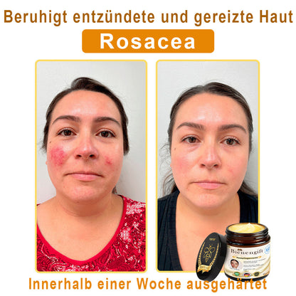 Nur 5 Gläser verfügbar! Holen Sie sich 50% Rabatt! Halten Sie Ihre Haut in 1-4 Wochen strahlend und jugendlich. Verpassen Sie nicht diese Chance – das Angebot gibt es erst im nächsten Jahr wieder. 180 Tage Geld-zurück-Garantie! Schnell handeln!🔥