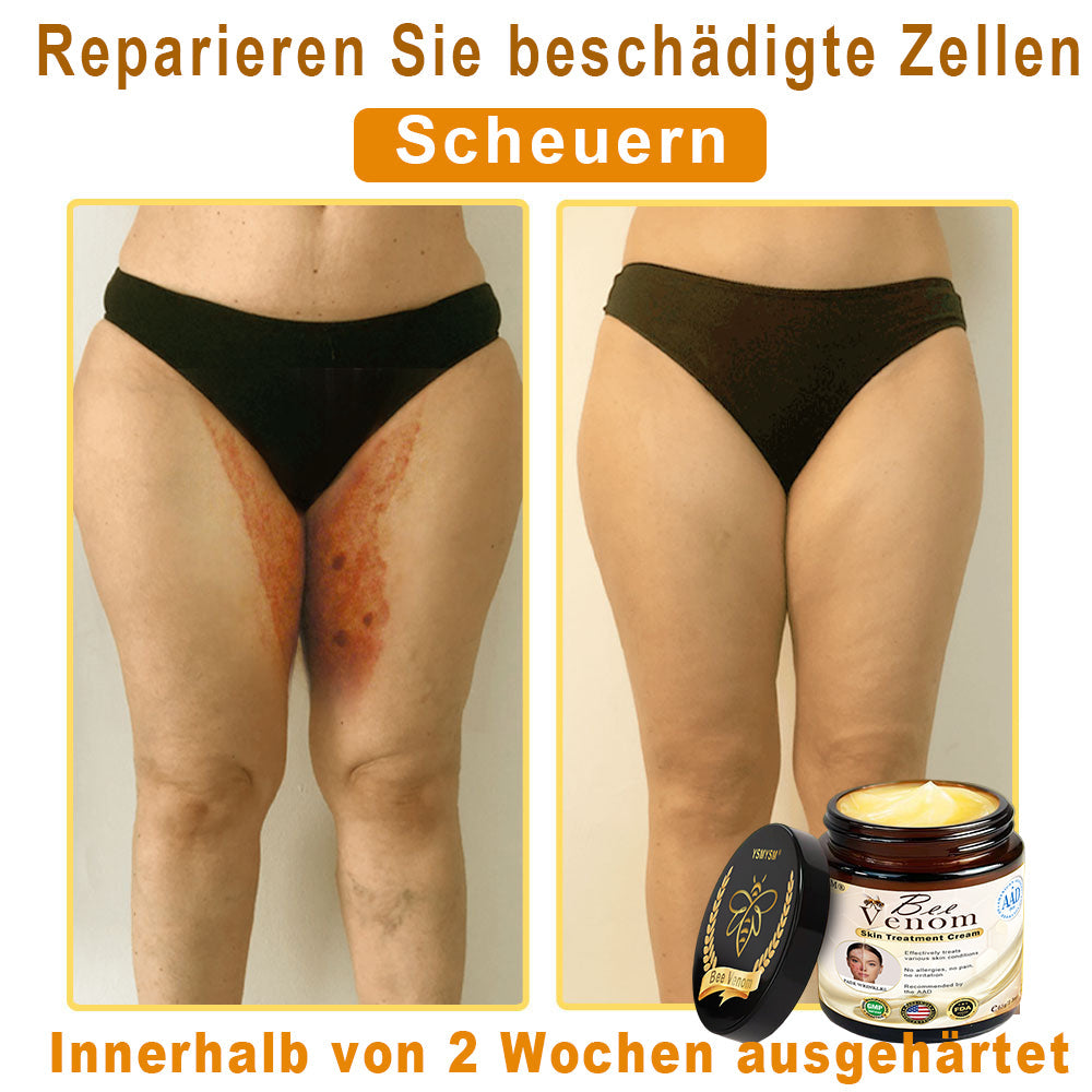 Nur 5 Gläser verfügbar! Holen Sie sich 50% Rabatt! Halten Sie Ihre Haut in 1-4 Wochen strahlend und jugendlich. Verpassen Sie nicht diese Chance – das Angebot gibt es erst im nächsten Jahr wieder. 180 Tage Geld-zurück-Garantie! Schnell handeln!🔥