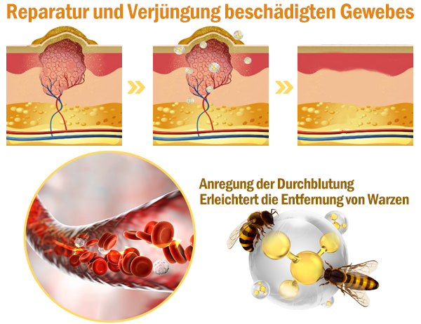 Eine letzte Chance! Schnappen Sie sich diesen Glücksfund mit 70% Rabatt!🔥180 Tage Geld-zurück-Garantie! Kostenloser Luftversand!