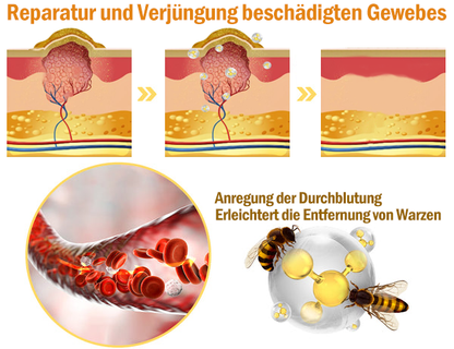 (Letzter Tag 80% Rabatt) YSMYSM® leistungsstarke Ganzkörper-Hautpflegecreme