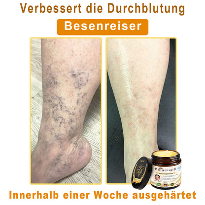 Nur 5 Gläser verfügbar! Holen Sie sich 50% Rabatt! Halten Sie Ihre Haut in 1-4 Wochen strahlend und jugendlich. Verpassen Sie nicht diese Chance – das Angebot gibt es erst im nächsten Jahr wieder. 180 Tage Geld-zurück-Garantie! Schnell handeln!🔥