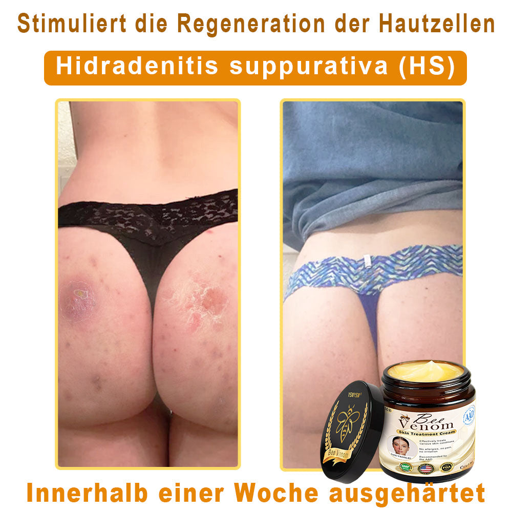 Nur 5 Gläser verfügbar! Holen Sie sich 50% Rabatt! Halten Sie Ihre Haut in 1-4 Wochen strahlend und jugendlich. Verpassen Sie nicht diese Chance – das Angebot gibt es erst im nächsten Jahr wieder. 180 Tage Geld-zurück-Garantie! Schnell handeln!🔥